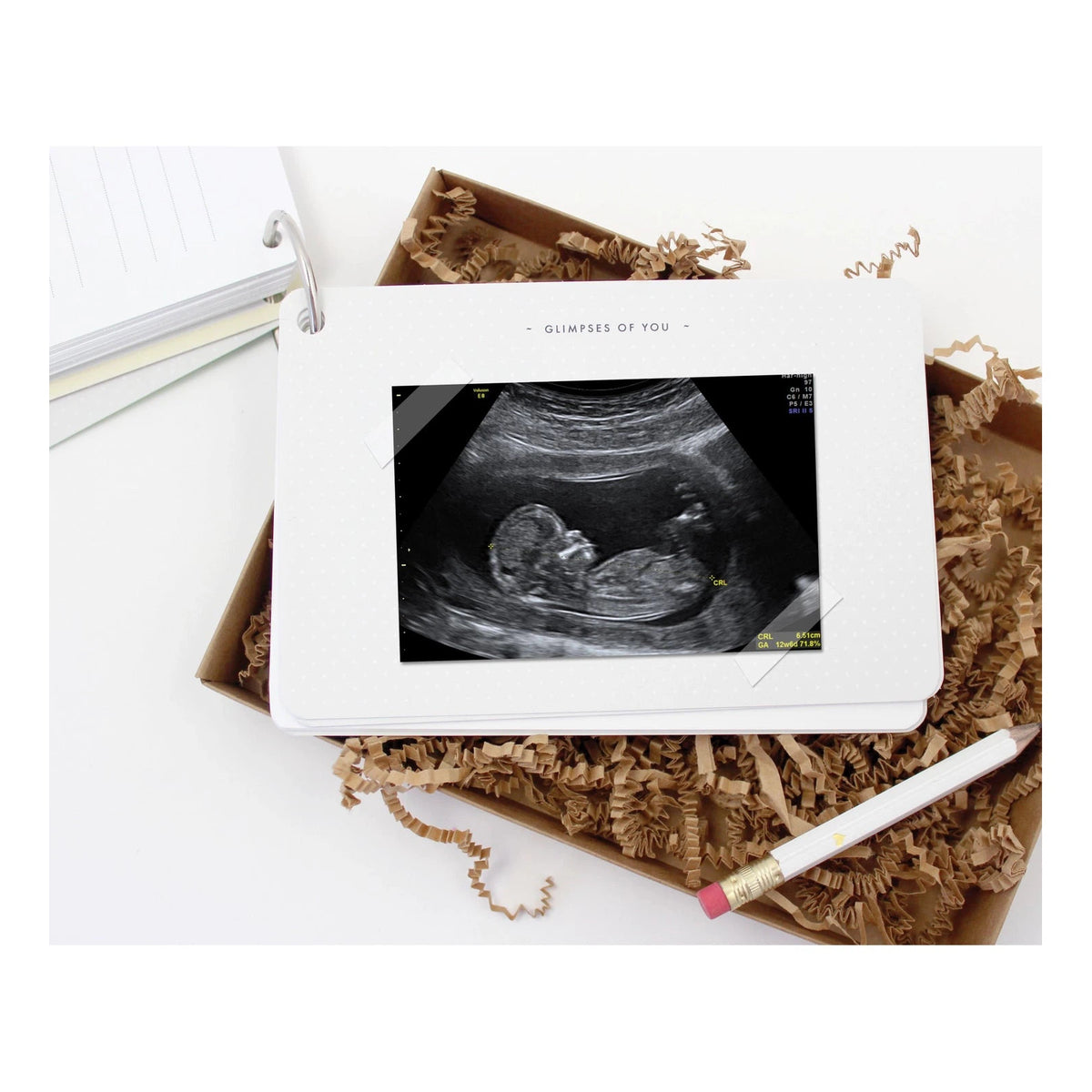 The Baby Bump Journal